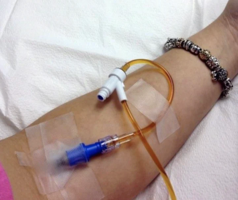 A close-up of a person's forearm with a medical IV line attached, secured with tape, and a decorative bracelet visible on the wrist, set against a white background.